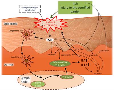 Atopic Dermatitis Studies through In Vitro Models